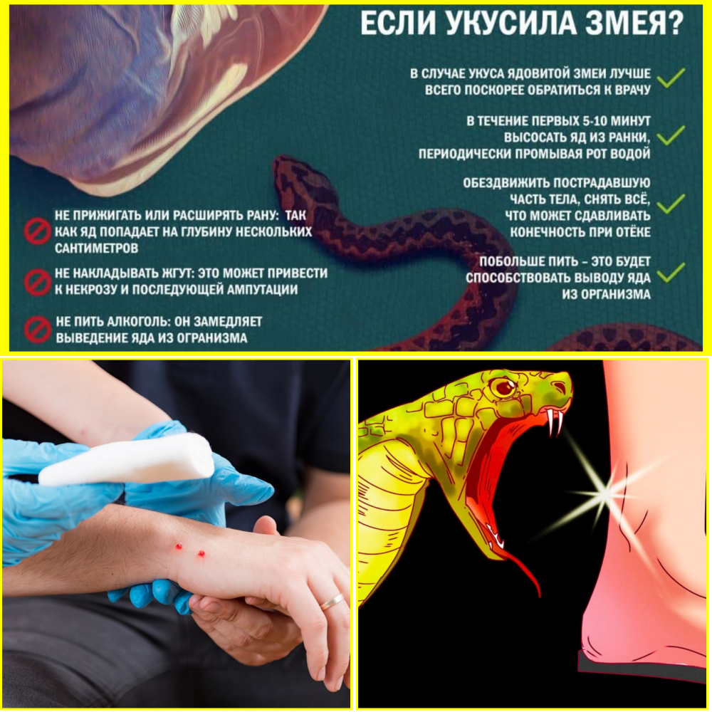 Что нужно делать при ускусе змеи
